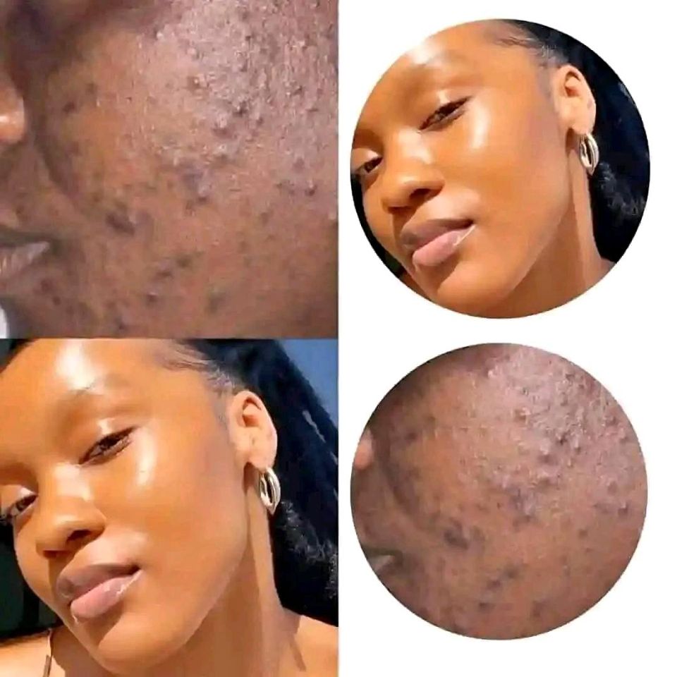 Flawless Skin Face Soap - Melanin Goodies Co.